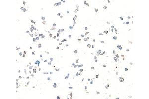 Immunocytochemistry (ICC) image for anti-Syndecan 1 (SDC1) (AA 23-251) antibody (ABIN7795739)