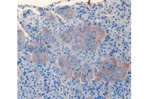 IHC-P analysis of adrenal gland tissue, with DAB staining. (SLIT3 antibody  (AA 62-119))