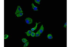 Immunofluorescence staining of MCF-7 cells with ABIN7175658 at 1:100, counter-stained with DAPI. (SORCS1 antibody  (AA 34-175))