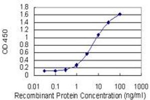 Detection limit for recombinant GST tagged LBX1 is 0. (Lbx1 antibody  (AA 133-219))