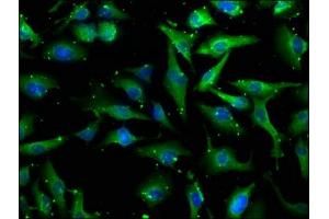 Immunofluorescence staining of U251 cells with ABIN7139928 at 1:100, counter-stained with DAPI. (MDFIC antibody  (AA 35-53))