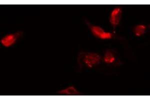ABIN6272364 staining Hela by IF/ICC. (ZC3HC1 antibody  (C-Term))