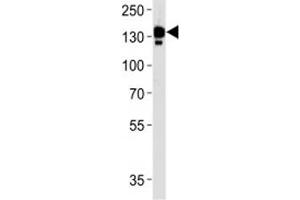 Western Blotting (WB) image for anti-Ceruloplasmin (Ferroxidase) (CP) (AA 121-151) antibody (ABIN3030467)