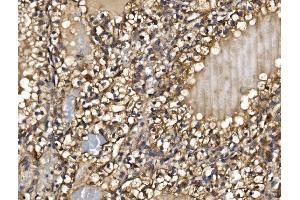 IHC analysis of PMPCA/INPP5 using anti-PMPCA/INPP5 antibody (ABIN7602722). (PMPCA antibody  (AA 99-525))