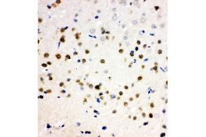 Anti-PLK2 antibody, IHC(P) IHC(P): Rat Brain Tissue (PLK2 antibody  (C-Term))