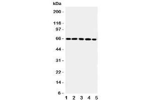 Western blot testing of RGS14 antibody and Lane 1:  rat thymus (RGS14 antibody  (C-Term))