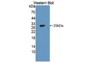 Western Blotting (WB) image for anti-Dipeptidyl-Peptidase 4 (DPP4) (AA 484-728) antibody (ABIN1173872) (DPP4 antibody  (AA 484-728))