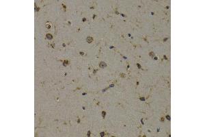 Immunohistochemistry of paraffin-embedded mouse brain using EEF1D antibody (ABIN5971342) at dilution of 1/200 (40x lens). (EEF1D antibody)