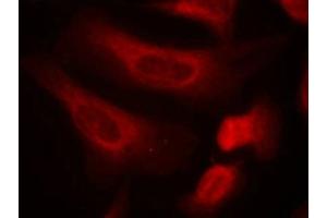 Immunofluorescence staining of methanol-fixed Hela cells using STAT1(Phospho-Ser727) Antibody. (STAT1 antibody  (pSer727))
