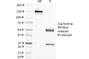 SDS-PAGE Analysis Purified CEA Mouse Monoclonal Antibody (C66/1291). (CEACAM5 antibody)