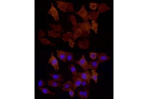 Immunofluorescence analysis of  cells using CD146/MCAM Rabbit pAb (ABIN6127568, ABIN6143621, ABIN6143622 and ABIN6218100) at dilution of 1:50 (40x lens). (MCAM antibody  (AA 447-646))