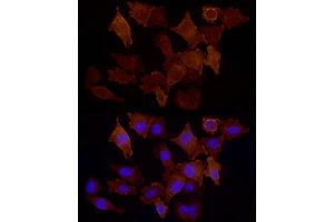 Immunofluorescence analysis of  cells using CD146/MCAM Rabbit pAb (ABIN6127568, ABIN6143621, ABIN6143622 and ABIN6218100) at dilution of 1:50 (40x lens). (MCAM antibody  (AA 447-646))