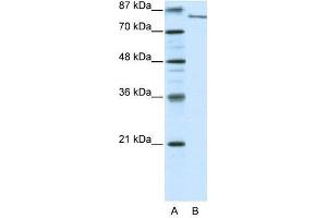 FBXL11 antibody used at 0.