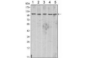 Western Blot showing CDH2 antibody used against A431 (1), NIH/3T3 (2), Hela (3), C6 (4) and LNCap (5) cell lysate. (N-Cadherin antibody)