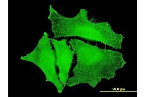 Immunofluorescence of monoclonal antibody to PKP4 on HeLa cell. (Plakophilin 4 antibody  (AA 12-110))