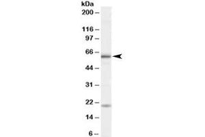 Western blot testing of HeLa cell lysate with BMPR1A antibody at 1ug/ml. (BMPR1A antibody)
