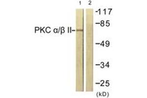 Western blot analysis of extracts from NIH-3T3 cells, treated with UV 15', using PKC alpha (Ab-638) Antibody. (PKC alpha antibody  (AA 606-655))