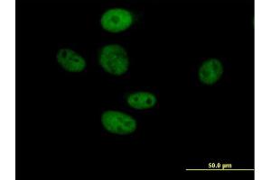 Immunofluorescence of purified MaxPab antibody to TLE3 on HeLa cell. (TLE3 antibody  (AA 1-772))