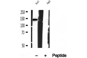 Western blot analysis of extracts of HepG2 cells, using IFT140 antibody.