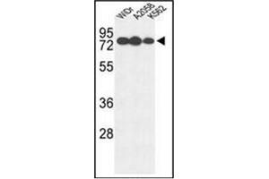 Western blot analysis of Beta-glucuronidase Antibody (Center) in WiDr, A2058, K562 cell line lysates (35ug/lane). (Glucuronidase beta antibody  (Middle Region))