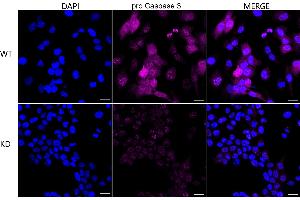 Immunocytochemical staining of HeLa cells using pro Caspase 3 antibody (ABIN7799900), 1:1,000), Top panel: wild-type (WT), Bottom panal: pro Caspase 3 shRNA knockdown (KD).