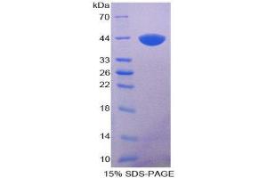 SDS-PAGE (SDS) image for Keratin 5 (KRT5) (AA 168-481) protein (His tag) (ABIN1080148)