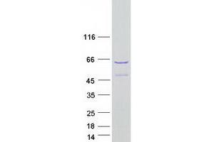 Validation with Western Blot