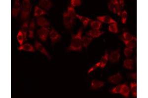 ABIN6275242 staining Hela by IF/ICC. (MRPL3 antibody  (N-Term))