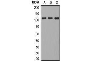 Western blot analysis of CD101 expression in HEK293T (A), mouse brain (B), H9C2 (C) whole cell lysates. (CD101 antibody  (Center))