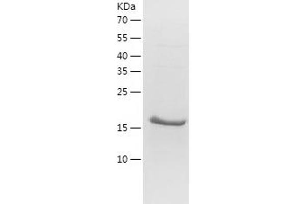 Osteoprotegerin Protein (AA 201-401) (His tag)