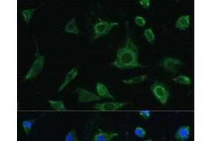 Immunofluorescence analysis of L-929 cells using OSM Polyclonal Antibody at dilution of 1:100. (Oncostatin M antibody)