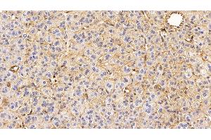 Immunohistochemistry (IHC) image for anti-Epidermal Growth Factor Receptor (EGFR) (AA 888-1210) antibody (ABIN7426025)