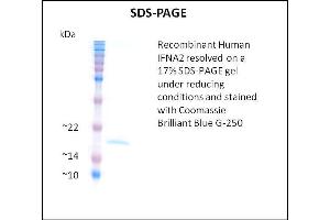 SDS-PAGE (SDS) image for Interferon, alpha 2 (IFNA2) (Active) protein (ABIN5509397) (IFNA2 Protein)