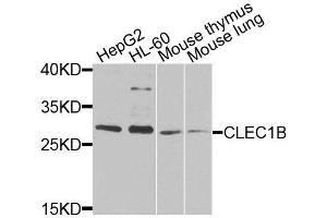 Western blot analysis of extracts of various cell lines, using CLEC1B antibody (ABIN6003679) at 1/1000 dilution. (C-Type Lectin Domain Family 1, Member B (CLEC1B) antibody)