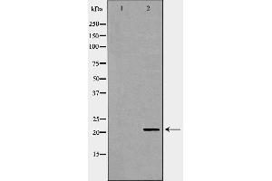 Western blot analysis of Hela whole cell lysates, using DHFR Antibody. (Dihydrofolate Reductase antibody)