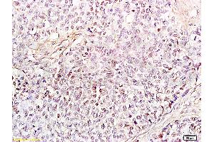 Immunohistochemistry (IHC) image for anti-High Mobility Group Box 1 (HMGB1) (AA 75-170) antibody (ABIN671616)