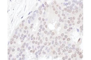 Immunohistochemistry (IHC) image for anti-YLP Motif Containing 1 (YLPM1) (AA 1350-1400) antibody (ABIN7455004) (YLPM1 antibody  (AA 1350-1400))