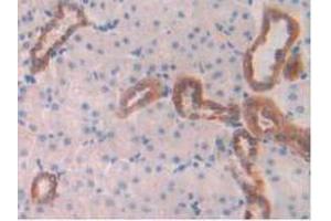 IHC-P analysis of Rat Kidney Tissue, with DAB staining. (Cathepsin D antibody  (AA 120-407))