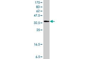 Western Blot detection against Immunogen (37. (FSHR antibody  (AA 18-120))