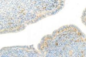 Immunohistochemistry analysis of paraffin-embedded mouse uterus using,NRK (ABIN7074842) at dilution of 1: 1500 (NRK antibody)