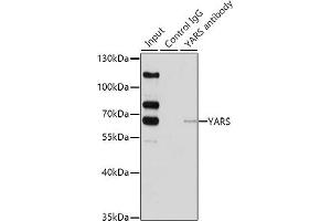 Immunoprecipitation analysis of 200 μg extracts of HeLa cells using 1 μg YARS antibody (ABIN6128883, ABIN6150324, ABIN6150325 and ABIN6222537). (YARS antibody  (AA 1-300))