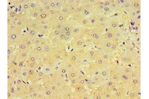 Immunohistochemistry of paraffin-embedded human liver tissue using ABIN7148439 at dilution of 1:100 (CRX antibody  (AA 120-285))