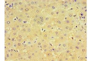 Immunohistochemistry of paraffin-embedded human liver tissue using ABIN7148439 at dilution of 1:100