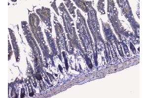 IHC analysis of RALBP1 using anti-RALBP1 antibody (ABIN5692936).