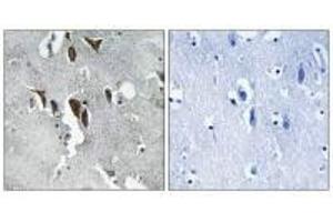Immunohistochemistry analysis of paraffin-embedded human brain tissue using ELOVL5 antibody. (ELOVL5 antibody)