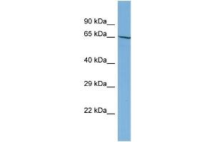 Host:  Rabbit  Target Name:  NOBOX  Sample Type:  HT1080 Whole Cell lysates  Antibody Dilution:  1. (NOBOX antibody  (N-Term))