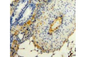 Used in DAB staining on fromalin fixed paraffin-embedded Lung tissue (JAM2 antibody  (AA 74-250))