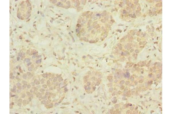 MRPL46 antibody  (AA 28-153)
