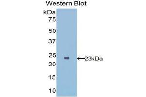 Western blot analysis of the recombinant protein. (IL1RL1 antibody  (AA 162-349))