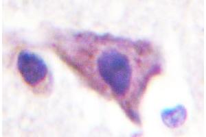 Image no. 2 for anti-Potassium Inwardly-Rectifying Channel, Subfamily J, Member 16 (KCNJ16) antibody (ABIN317797) (KIR5.1 antibody)